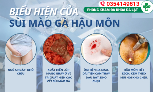 Hình ảnh minh họa